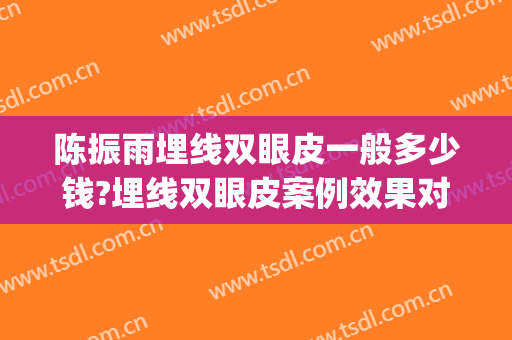 陈振雨埋线双眼皮一般多少钱?埋线双眼皮案例效果对比图_青岛大学附属医院