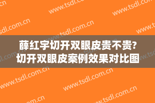 薛红宇切开双眼皮贵不贵?切开双眼皮案例效果对比图_北京大学第三医院