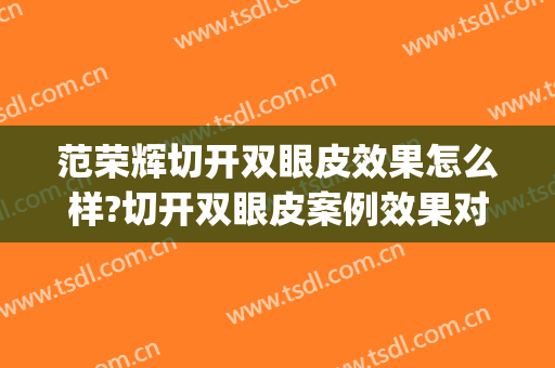 范荣辉切开双眼皮效果怎么样?切开双眼皮案例效果对比图_陕西省人民医院