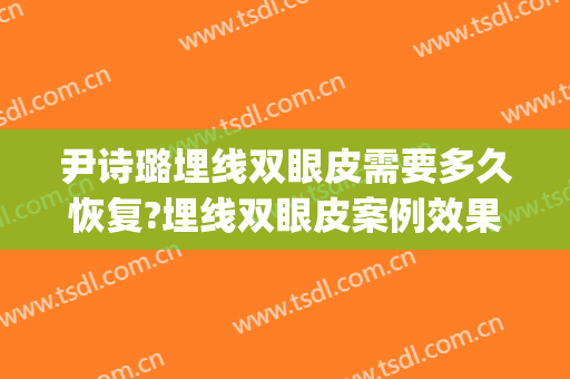 尹诗璐埋线双眼皮需要多久恢复?埋线双眼皮案例效果对比图_北京大学第三医院