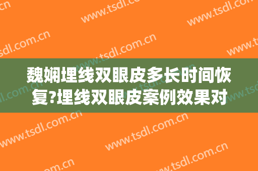 魏娴埋线双眼皮多长时间恢复?埋线双眼皮案例效果对比图_上海交通大学医学院附属第九人民医院
