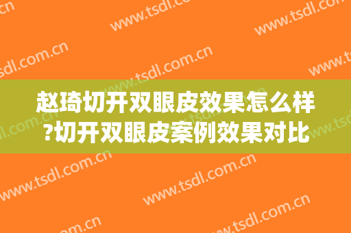 赵琦切开双眼皮效果怎么样?切开双眼皮案例效果对比图_山东大学齐鲁医院