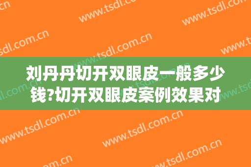 刘丹丹切开双眼皮一般多少钱?切开双眼皮案例效果对比图_北京大学深圳医院