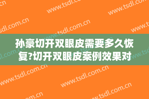 孙豪切开双眼皮需要多久恢复?切开双眼皮案例效果对比图_杭州整形医院