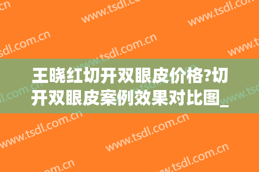 王晓红切开双眼皮价格?切开双眼皮案例效果对比图_威海市中心医院(双眼皮大夫)