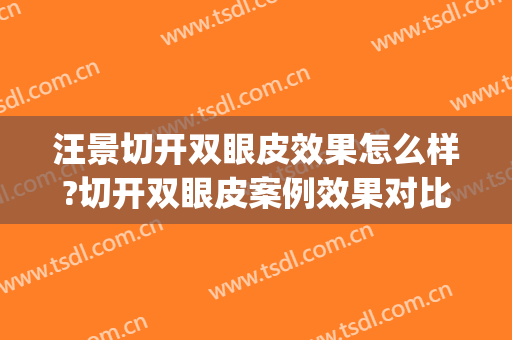 汪景切开双眼皮效果怎么样?切开双眼皮案例效果对比图_上海市儿童医院