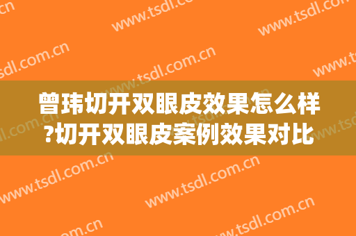 曾玮切开双眼皮效果怎么样?切开双眼皮案例效果对比图_好大夫工作室