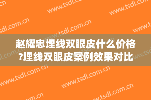 赵耀忠埋线双眼皮什么价格?埋线双眼皮案例效果对比图_上海长征医院