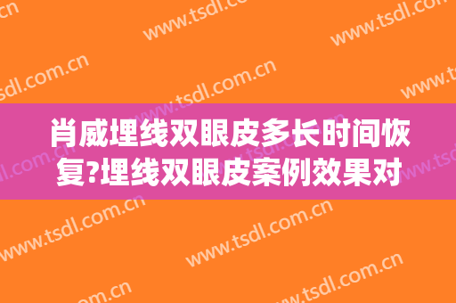 肖威埋线双眼皮多长时间恢复?埋线双眼皮案例效果对比图_浙江大学医学院附属第一医院
