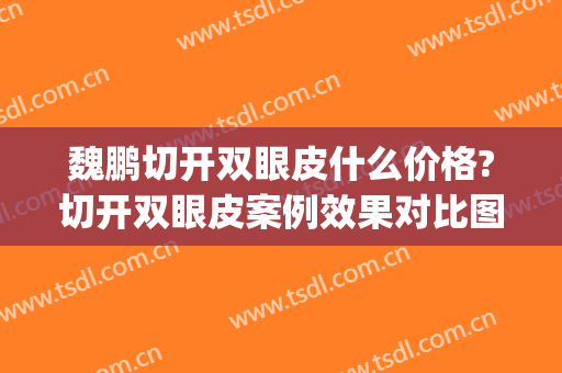 魏鹏切开双眼皮什么价格?切开双眼皮案例效果对比图_宁波市第一医院