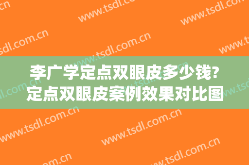 李广学定点双眼皮多少钱?定点双眼皮案例效果对比图_北京大学人民医院