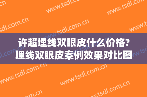 许超埋线双眼皮什么价格?埋线双眼皮案例效果对比图_淄博市中心医院