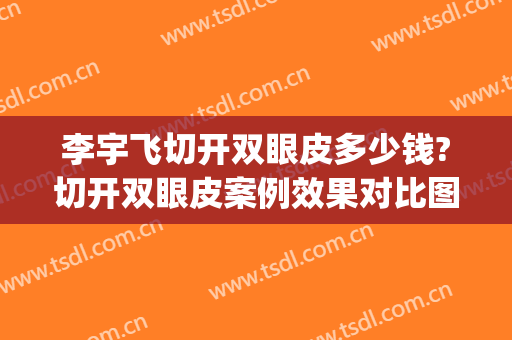 李宇飞切开双眼皮多少钱?切开双眼皮案例效果对比图_上海市东方医院