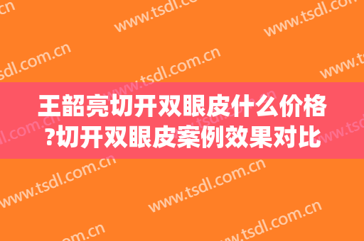 王韶亮切开双眼皮什么价格?切开双眼皮案例效果对比图_陆军军医大学新桥医院