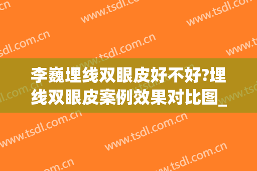 李巍埋线双眼皮好不好?埋线双眼皮案例效果对比图_首都医科大学附属北京天坛医院