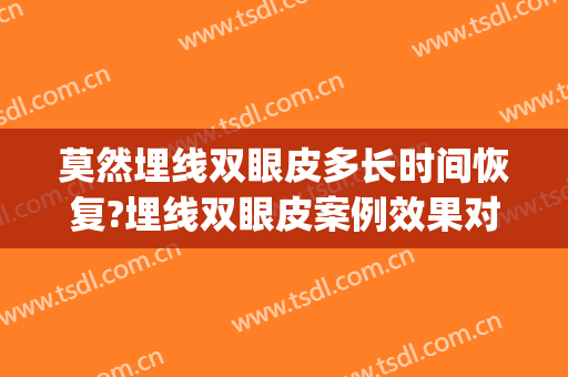 莫然埋线双眼皮多长时间恢复?埋线双眼皮案例效果对比图_南京鼓楼医院