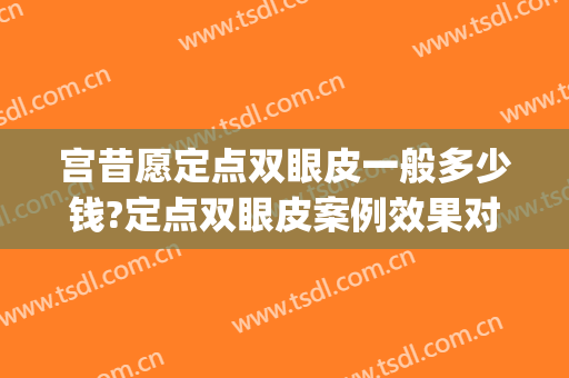 宫昔愿定点双眼皮一般多少钱?定点双眼皮案例效果对比图_济南市中心医院
