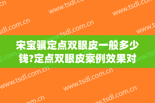 宋宝骥定点双眼皮一般多少钱?定点双眼皮案例效果对比图_天津市天津医院