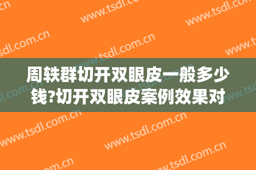 周轶群切开双眼皮一般多少钱?切开双眼皮案例效果对比图_复旦大学附属华东医院