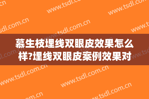 慕生枝埋线双眼皮效果怎么样?埋线双眼皮案例效果对比图_陕西省人民医院