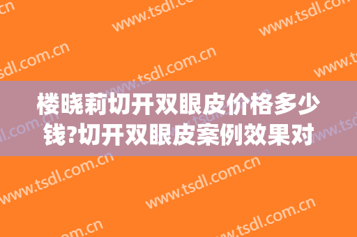楼晓莉切开双眼皮价格多少钱?切开双眼皮案例效果对比图_上海嘉会国际医院