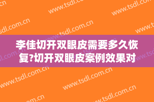 李佳切开双眼皮需要多久恢复?切开双眼皮案例效果对比图_好大夫工作室