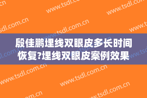 殷佳鹏埋线双眼皮多长时间恢复?埋线双眼皮案例效果对比图_厦门大学附属第一医院