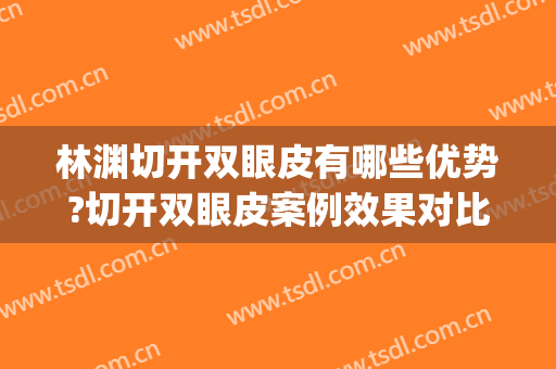 林渊切开双眼皮有哪些优势?切开双眼皮案例效果对比图_皖南医学院第一附属医院
