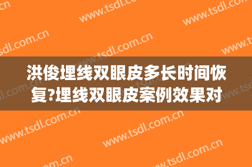 洪俊埋线双眼皮多长时间恢复?埋线双眼皮案例效果对比图_中山大学孙逸仙纪念医院