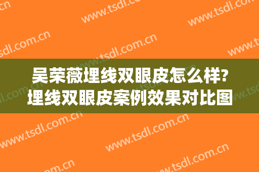 吴荣薇埋线双眼皮怎么样?埋线双眼皮案例效果对比图_中国医学科学院整形外科医院