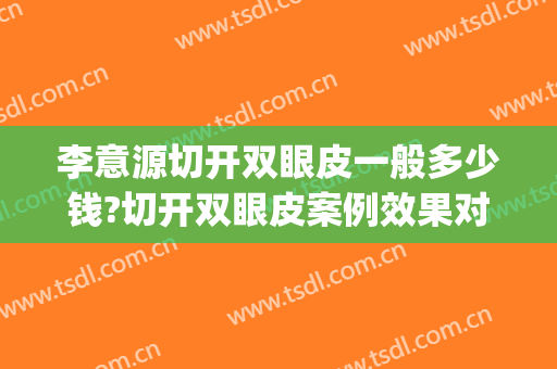 李意源切开双眼皮一般多少钱?切开双眼皮案例效果对比图_上海交通大学医学院附属第九人民医院