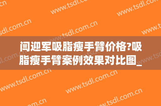 闫迎军吸脂瘦手臂价格?吸脂瘦手臂案例效果对比图_好大夫工作室(手臂吸脂前后效果图片)