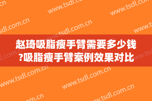 赵琦吸脂瘦手臂需要多少钱?吸脂瘦手臂案例效果对比图_山东大学齐鲁医院