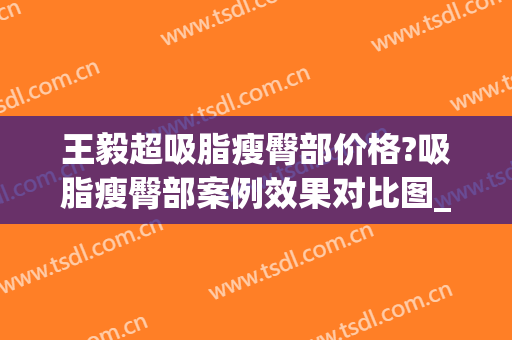 王毅超吸脂瘦臀部价格?吸脂瘦臀部案例效果对比图_北京大学第一医院