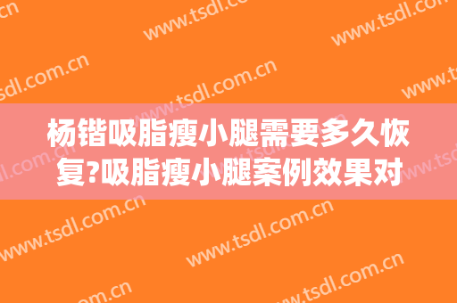 杨锴吸脂瘦小腿需要多久恢复?吸脂瘦小腿案例效果对比图_北京大学人民医院