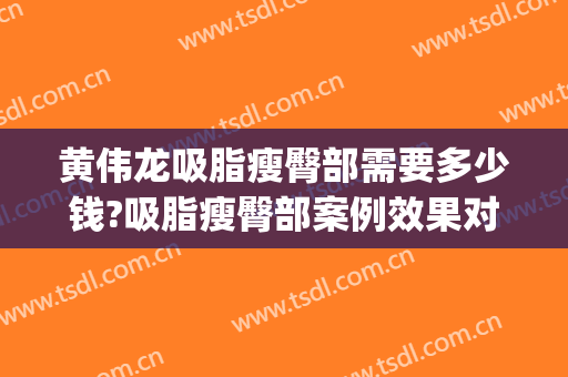 黄伟龙吸脂瘦臀部需要多少钱?吸脂瘦臀部案例效果对比图_东莞市人民医院
