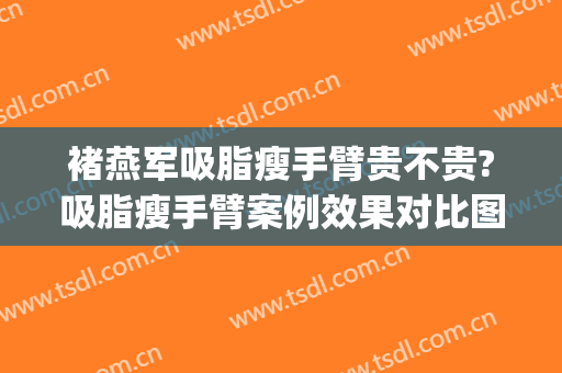 褚燕军吸脂瘦手臂贵不贵?吸脂瘦手臂案例效果对比图_中国科学技术大学附属第一医院