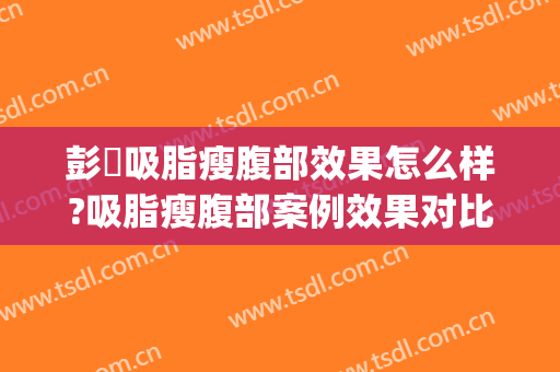 彭喆吸脂瘦腹部效果怎么样?吸脂瘦腹部案例效果对比图_北京大学人民医院