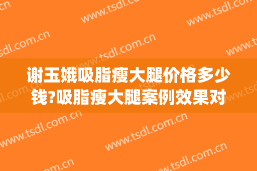 谢玉娥吸脂瘦大腿价格多少钱?吸脂瘦大腿案例效果对比图_河北工程大学附属医院