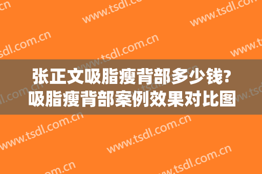 张正文吸脂瘦背部多少钱?吸脂瘦背部案例效果对比图_好大夫工作室(做背部吸脂价格多少)