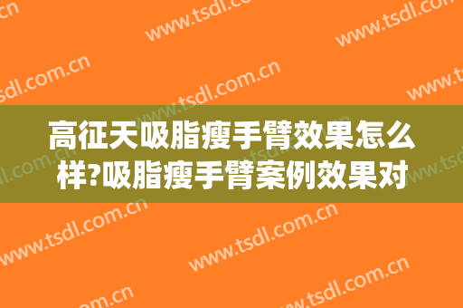 高征天吸脂瘦手臂效果怎么样?吸脂瘦手臂案例效果对比图_福州市第八医院