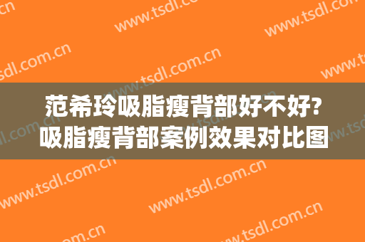 范希玲吸脂瘦背部好不好?吸脂瘦背部案例效果对比图_浙江大学医学院附属第一医院