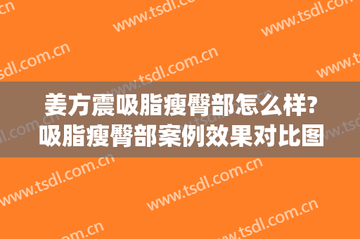 姜方震吸脂瘦臀部怎么样?吸脂瘦臀部案例效果对比图_好大夫工作室