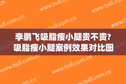 李鹏飞吸脂瘦小腿贵不贵?吸脂瘦小腿案例效果对比图_浙江大学医学院附属第一医院