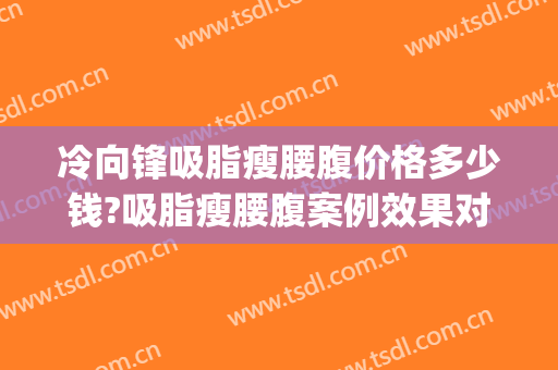 冷向锋吸脂瘦腰腹价格多少钱?吸脂瘦腰腹案例效果对比图_青岛大学附属医院