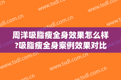周洋吸脂瘦全身效果怎么样?吸脂瘦全身案例效果对比图_中日友好医院