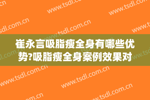 崔永言吸脂瘦全身有哪些优势?吸脂瘦全身案例效果对比图_北京大学深圳医院