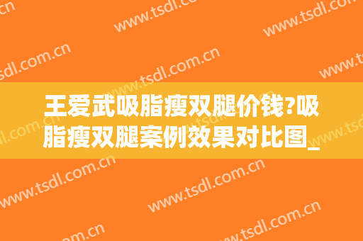 王爱武吸脂瘦双腿价钱?吸脂瘦双腿案例效果对比图_西安国际医学中心医院