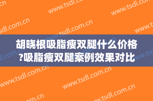 胡晓根吸脂瘦双腿什么价格?吸脂瘦双腿案例效果对比图_中日友好医院