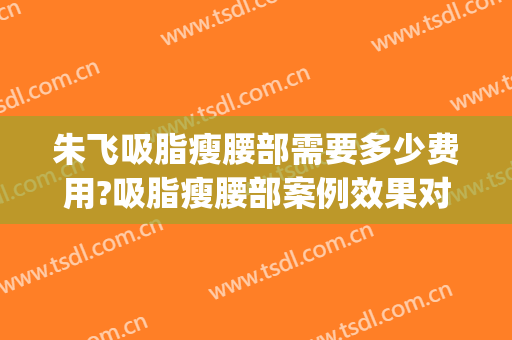 朱飞吸脂瘦腰部需要多少费用?吸脂瘦腰部案例效果对比图_安徽医科大学第一附属医院